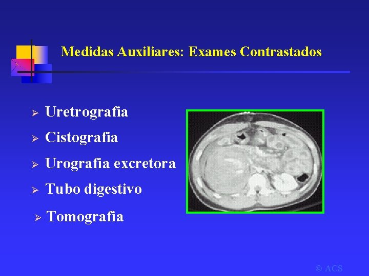 Medidas Auxiliares: Exames Contrastados Ø Uretrografia Ø Cistografia Ø Urografia excretora Ø Tubo digestivo