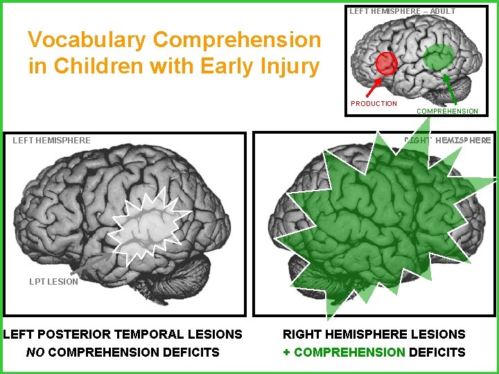 LEFT HEMISPHERE – ADULT Vocabulary Comprehension in Children with Early Injury PRODUCTION LEFT HEMISPHERE