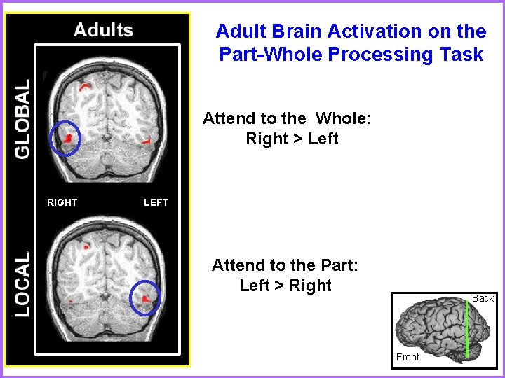 Adult Brain Activation on the Part-Whole Processing Task Attend to the Whole: Right >