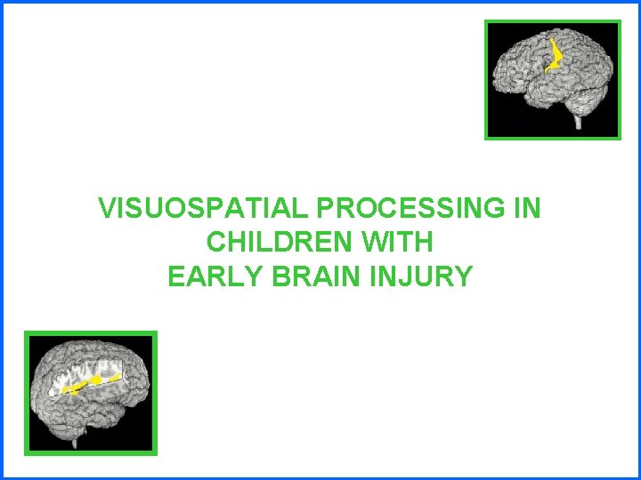 VISUOSPATIAL PROCESSING IN CHILDREN WITH EARLY BRAIN INJURY 