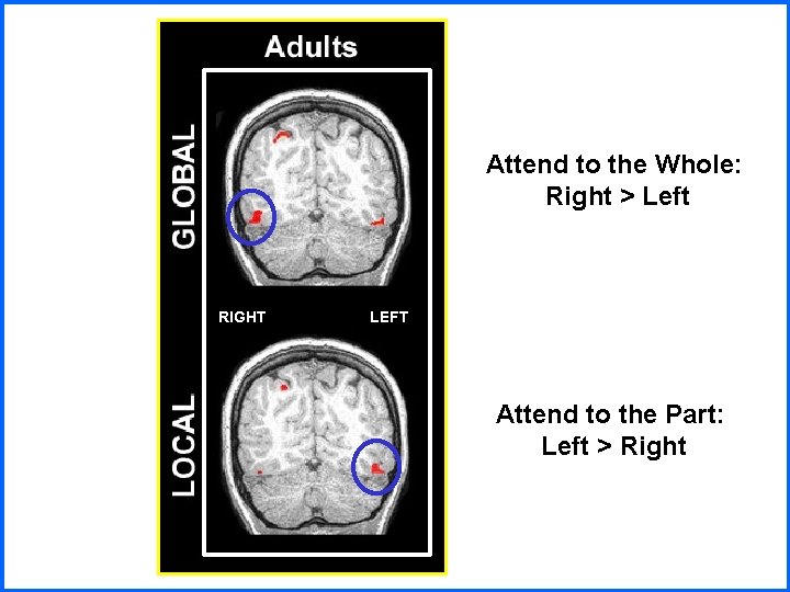 Attend to the Whole: Right > Left RIGHT LEFT Attend to the Part: Left