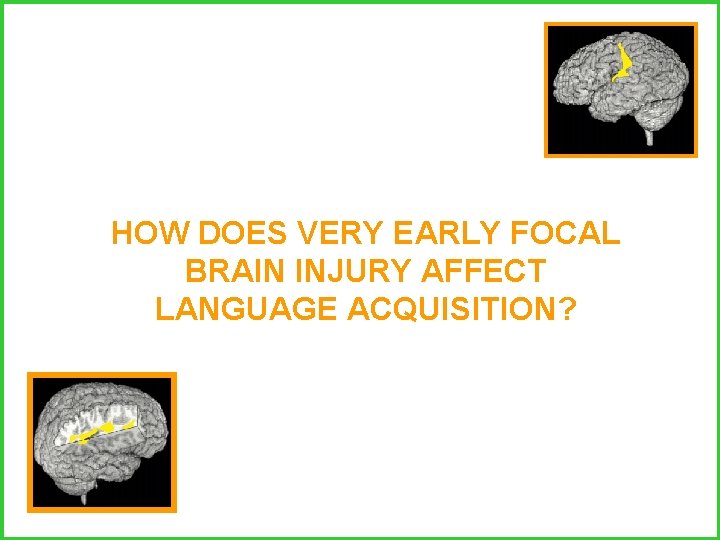 HOW DOES VERY EARLY FOCAL BRAIN INJURY AFFECT LANGUAGE ACQUISITION? 