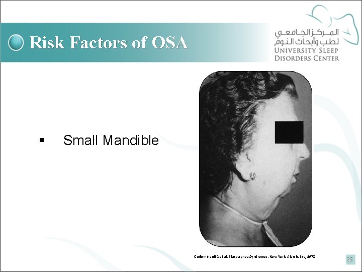 Risk Factors of OSA § Small Mandible Guilleminault C et al. Sleep apnea Syndromes.
