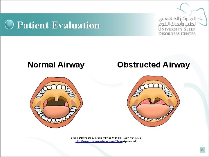 Patient Evaluation Normal Airway Obstructed Airway Sleep Disorders & Sleep Apnea with Dr. Kushner,