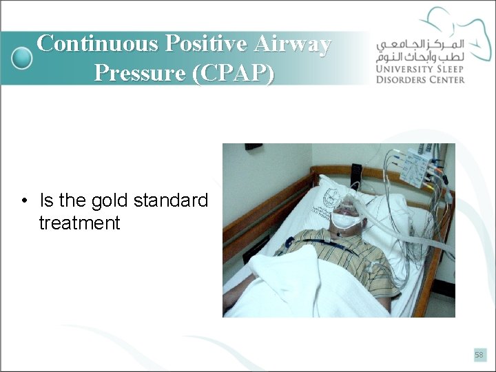 Continuous Positive Airway Pressure (CPAP) • Is the gold standard treatment 58 