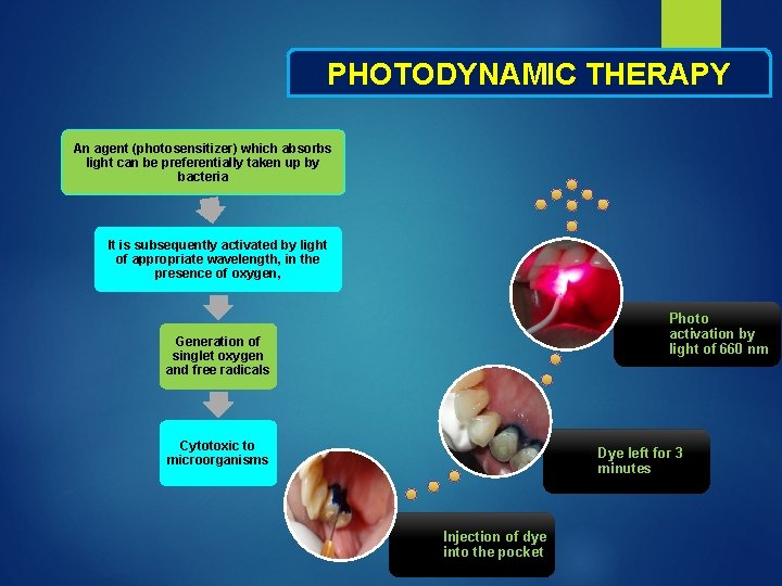 PHOTODYNAMIC THERAPY An agent (photosensitizer) which absorbs light can be preferentially taken up by