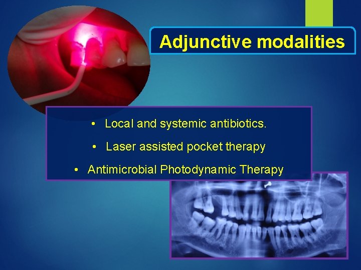 Adjunctive modalities • Local and systemic antibiotics. • Laser assisted pocket therapy • Antimicrobial