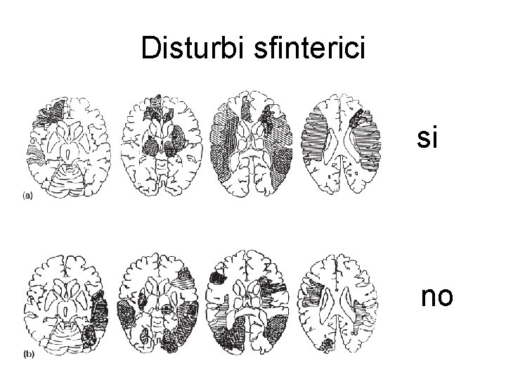 Disturbi sfinterici • si si no 