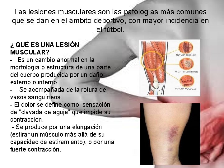 Las lesiones musculares son las patologías más comunes que se dan en el ámbito