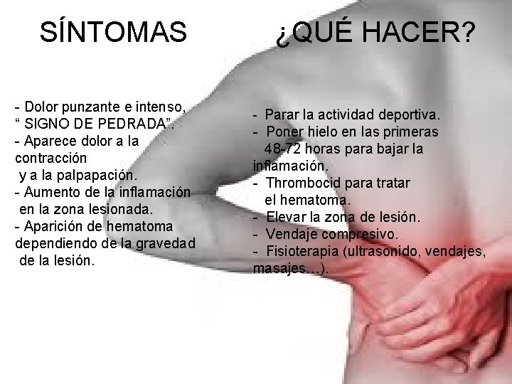 SÍNTOMAS - Dolor punzante e intenso, “ SIGNO DE PEDRADA”. - Aparece dolor a