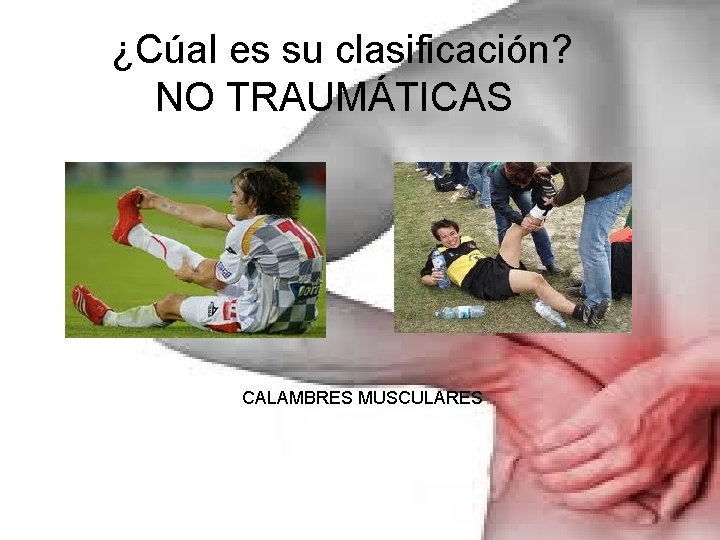 ¿Cúal es su clasificación? NO TRAUMÁTICAS CALAMBRES MUSCULARES 