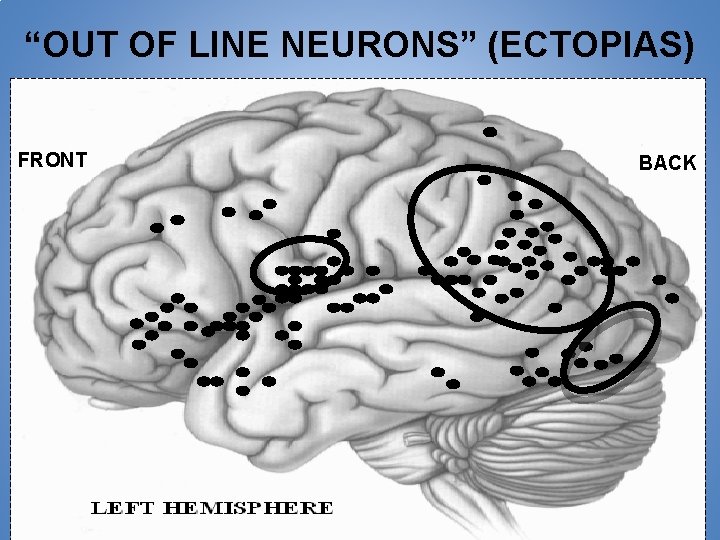 “OUT OF LINE NEURONS” (ECTOPIAS) FRONT BACK 