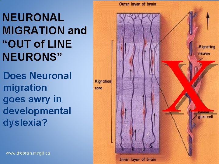 Does Neuronal migration goes awry in developmental dyslexia? www. thebrain. mcgill. ca X NEURONAL