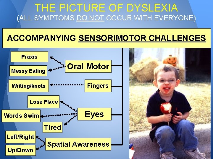 THE PICTURE OF DYSLEXIA (ALL SYMPTOMS DO NOT OCCUR WITH EVERYONE) ACCOMPANYING SENSORIMOTOR CHALLENGES
