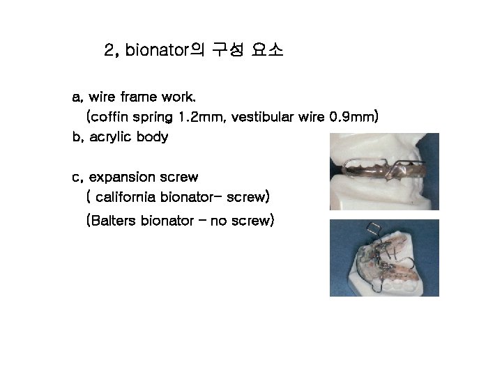 2, bionator의 구성 요소 a, wire frame work. (coffin spring 1. 2 mm, vestibular