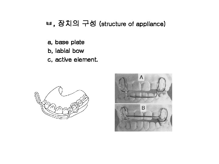 ㅂ, 장치의 구성 (structure of appliance) a, base plate b, labial bow c, active