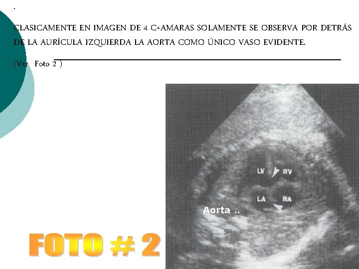 . CLASICAMENTE EN IMAGEN DE 4 C+AMARAS SOLAMENTE SE OBSERVA POR DETRÁS DE LA