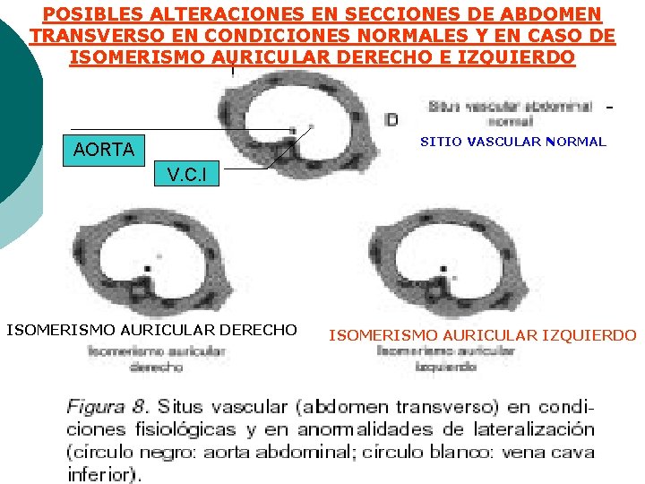 POSIBLES ALTERACIONES EN SECCIONES DE ABDOMEN TRANSVERSO EN CONDICIONES NORMALES Y EN CASO DE