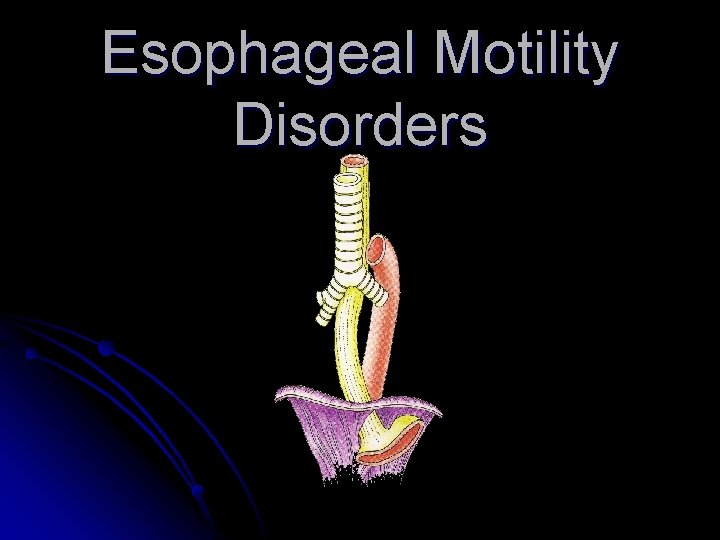 Esophageal Motility Disorders 