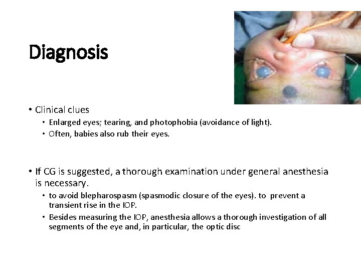 Diagnosis • Clinical clues • Enlarged eyes; tearing, and photophobia (avoidance of light). •