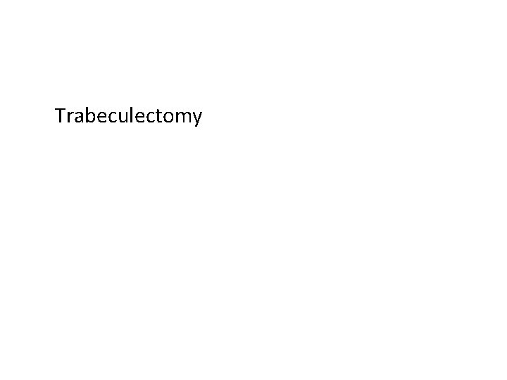  Trabeculectomy 