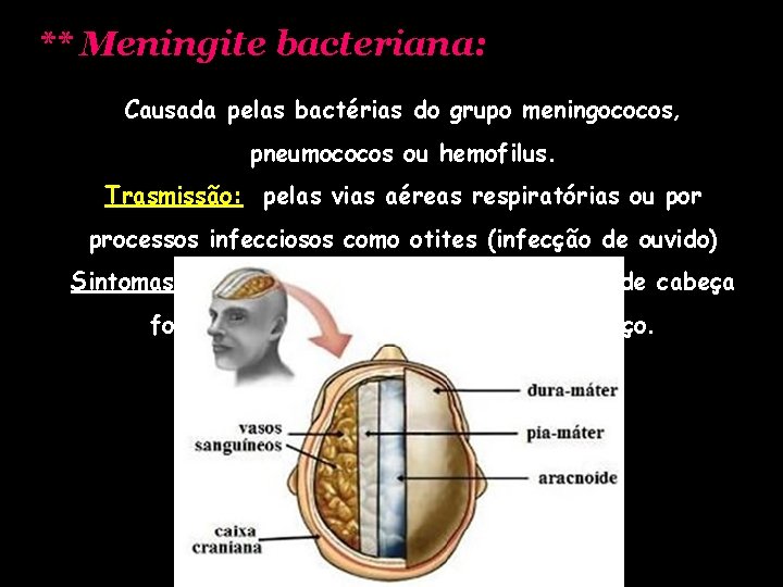 ** Meningite bacteriana: Causada pelas bactérias do grupo meningococos, pneumococos ou hemofilus. Trasmissão: pelas