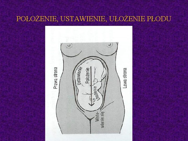 POŁOŻENIE, USTAWIENIE, UŁOŻENIE PŁODU 