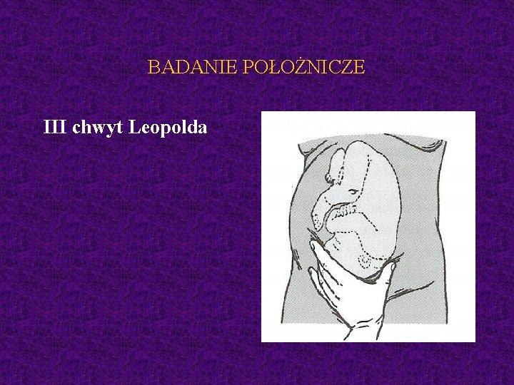 BADANIE POŁOŻNICZE III chwyt Leopolda 