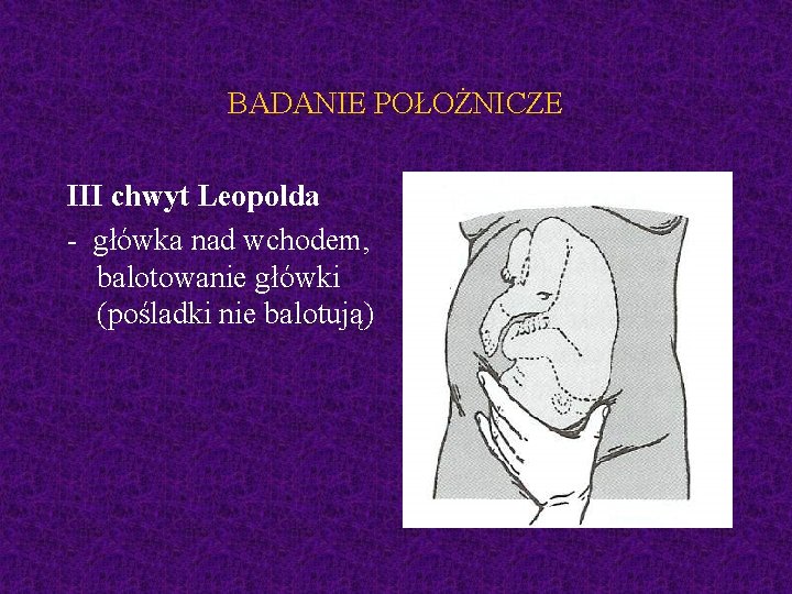 BADANIE POŁOŻNICZE III chwyt Leopolda - główka nad wchodem, balotowanie główki (pośladki nie balotują)