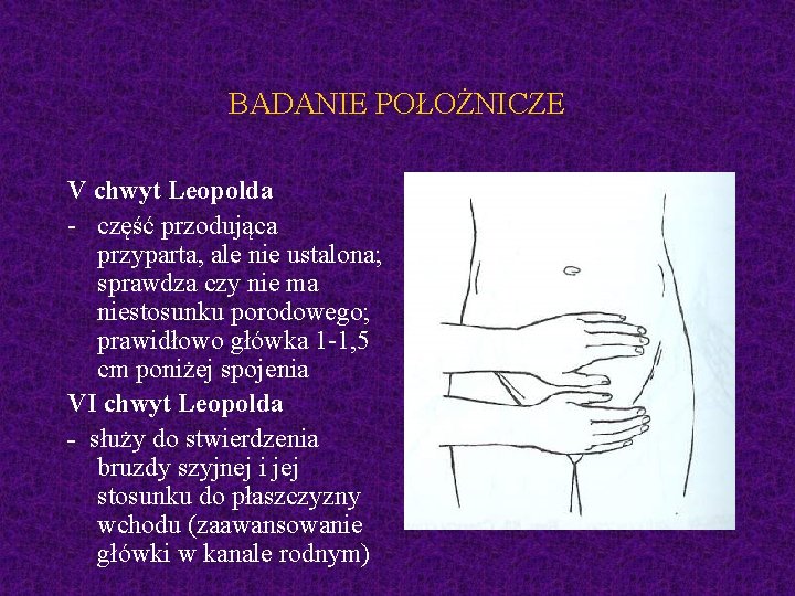 BADANIE POŁOŻNICZE V chwyt Leopolda - część przodująca przyparta, ale nie ustalona; sprawdza czy