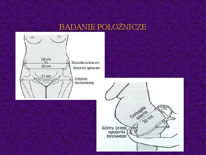 BADANIE POŁOŻNICZE 