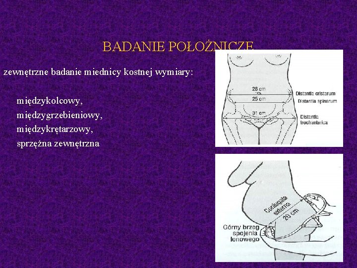 BADANIE POŁOŻNICZE zewnętrzne badanie miednicy kostnej wymiary: międzykolcowy, międzygrzebieniowy, międzykrętarzowy, sprzężna zewnętrzna 