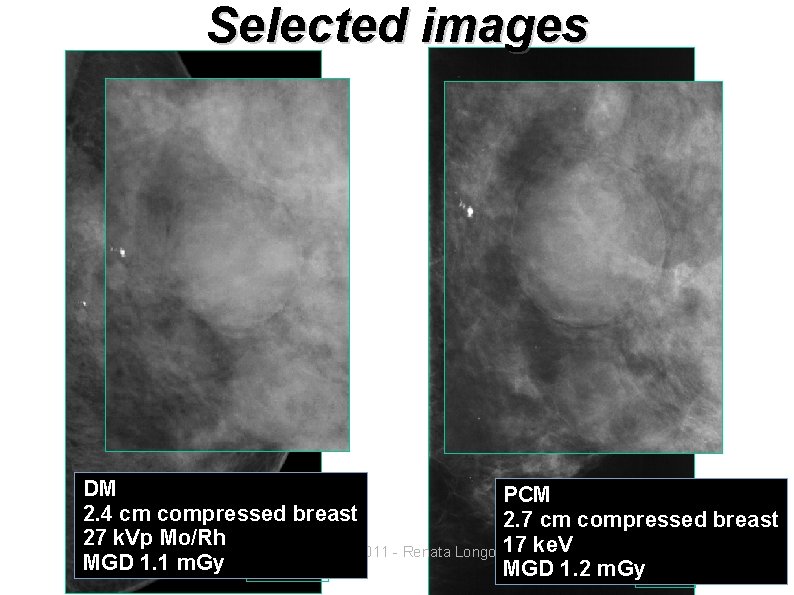 Selected images DM PCM 2. 4 cm compressed breast 2. 7 cm compressed breast