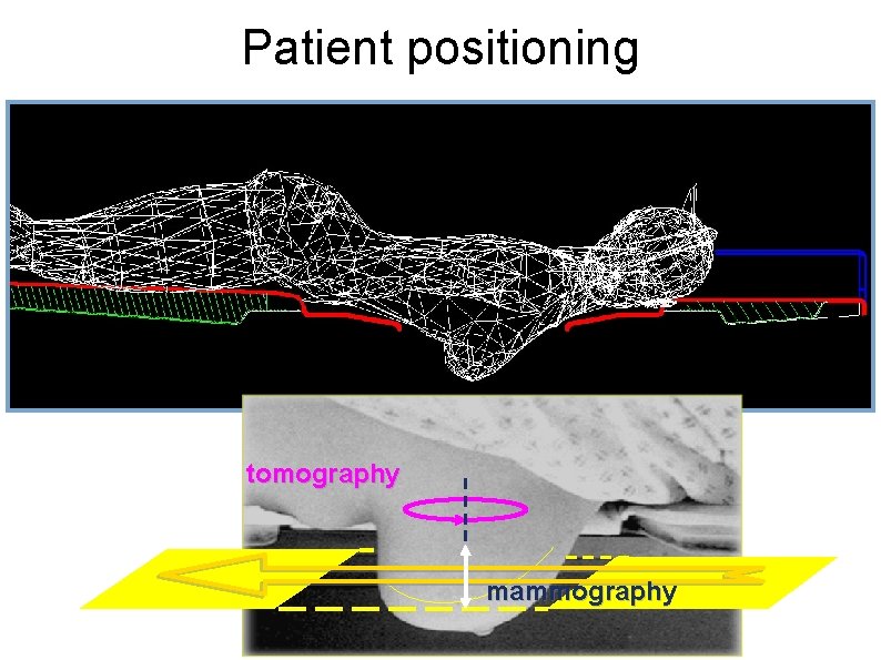 Patient positioning tomography mammography 