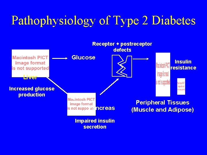Pathophysiology of Type 2 Diabetes Receptor + postreceptor defects Glucose Insulin resistance Liver Increased