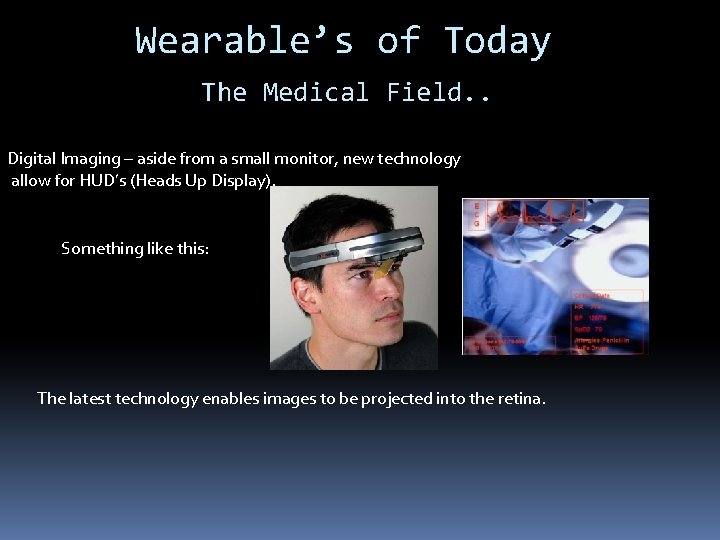 Wearable’s of Today The Medical Field. . Digital Imaging – aside from a small