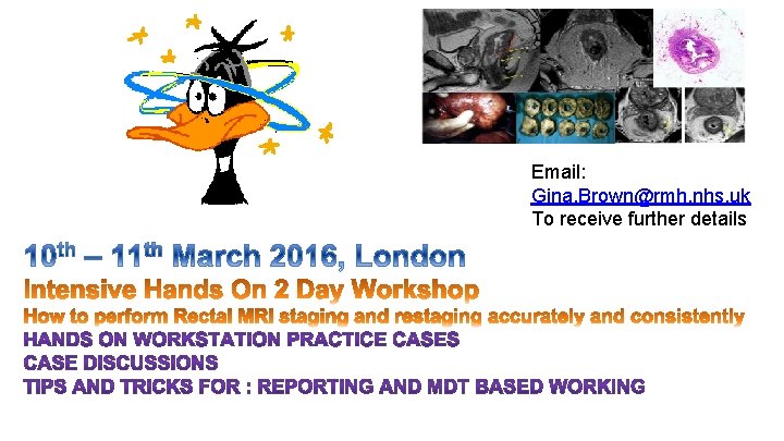 Email: Gina. Brown@rmh. nhs. uk To receive further details 