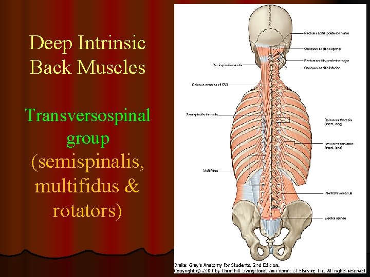 Deep Intrinsic Back Muscles Transversospinal group (semispinalis, multifidus & rotators) 