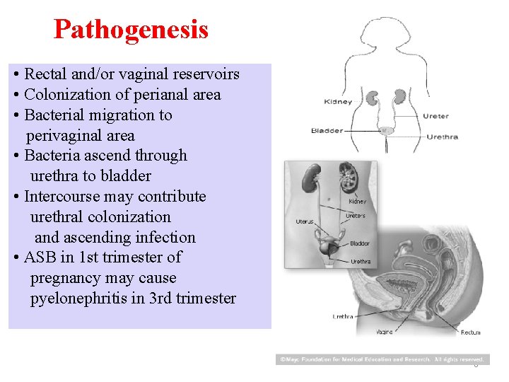 Pathogenesis • Rectal and/or vaginal reservoirs • Colonization of perianal area • Bacterial migration Pathogenesis • Rectal and/or vaginal reservoirs • Colonization of perianal area • Bacterial migration