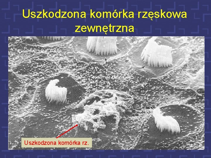 Uszkodzona komórka rzęskowa zewnętrzne Uszkodzona komórka rz. wewnętrzne 61 