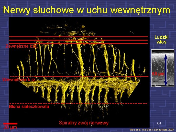 Nerwy słuchowe w uchu wewnętrznym Ludzki włos Zewnętrzne k. rz. 60 µm Wewnętrzne k.