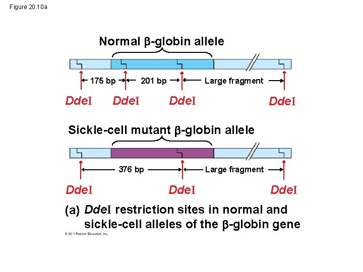 Figure 20. 10 a Normal -globin allele 175 bp Dde. I Large fragment 201