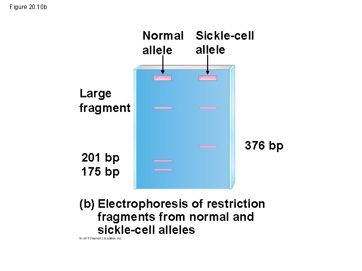 Figure 20. 10 b Normal Sickle-cell allele Large fragment 201 bp 175 bp 376