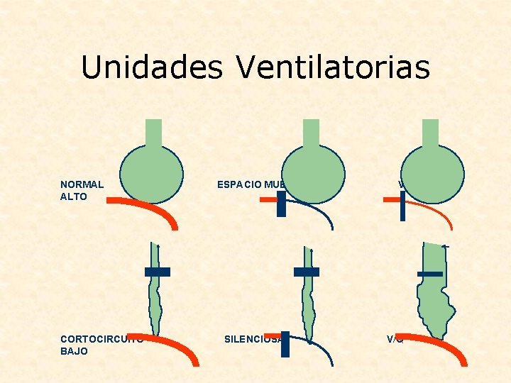 Unidades Ventilatorias NORMAL ALTO CORTOCIRCUITO BAJO ESPACIO MUERTO SILENCIOSA V/Q 