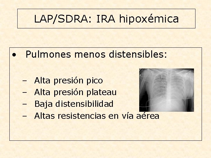 LAP/SDRA: IRA hipoxémica • Pulmones menos distensibles: – – Alta presión pico Alta presión