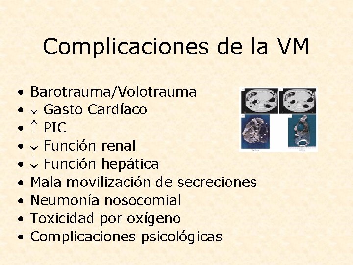 Complicaciones de la VM • • • Barotrauma/Volotrauma Gasto Cardíaco PIC Función renal Función