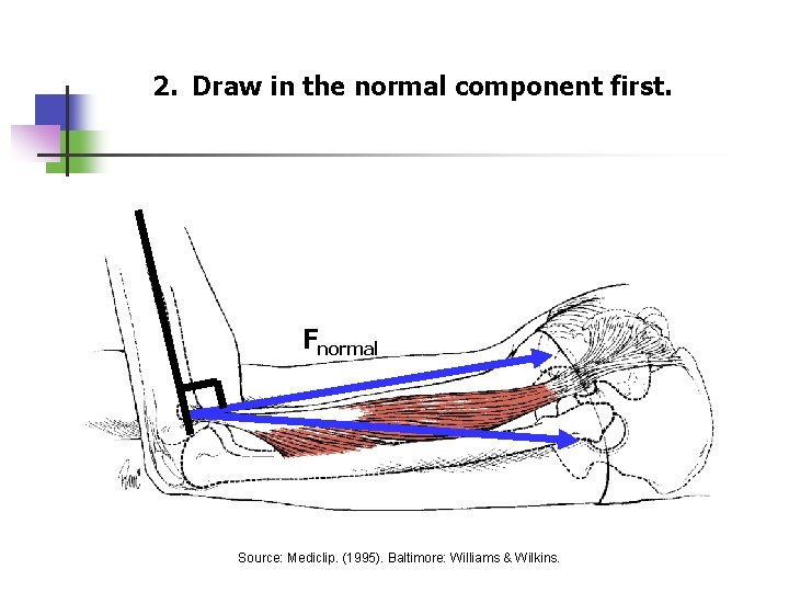 2. Draw in the normal component first. Fnormal Source: Mediclip. (1995). Baltimore: Williams &