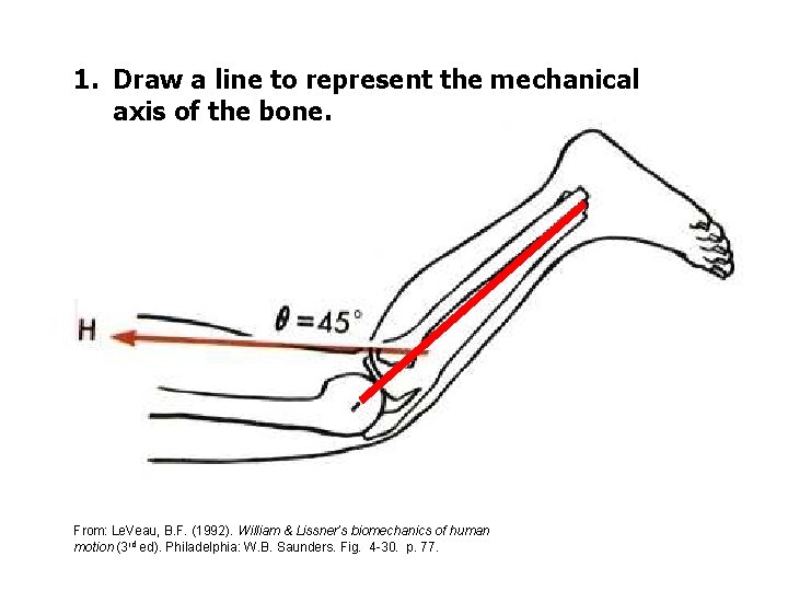 1. Draw a line to represent the mechanical axis of the bone. From: Le.