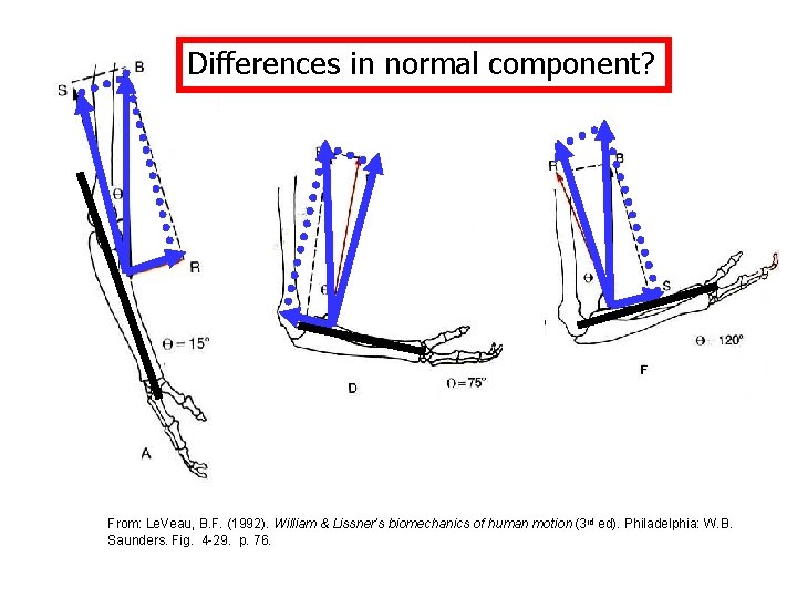 Differences in normal component? From: Le. Veau, B. F. (1992). William & Lissner’s biomechanics