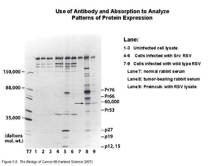Use of Antibody and Absorption to Analyze Patterns of Protein Expression Lane: 1 -3